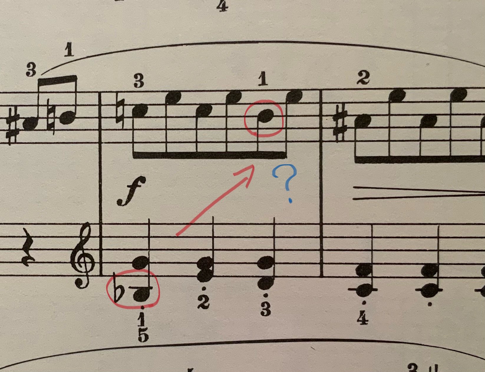 臨時記号のルール